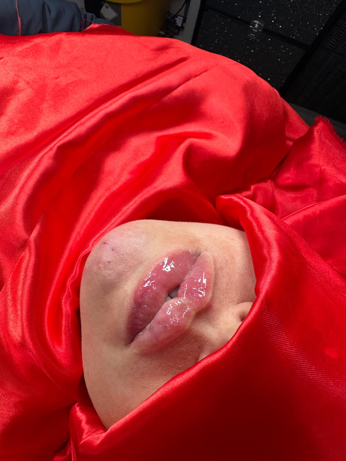 unnamed image