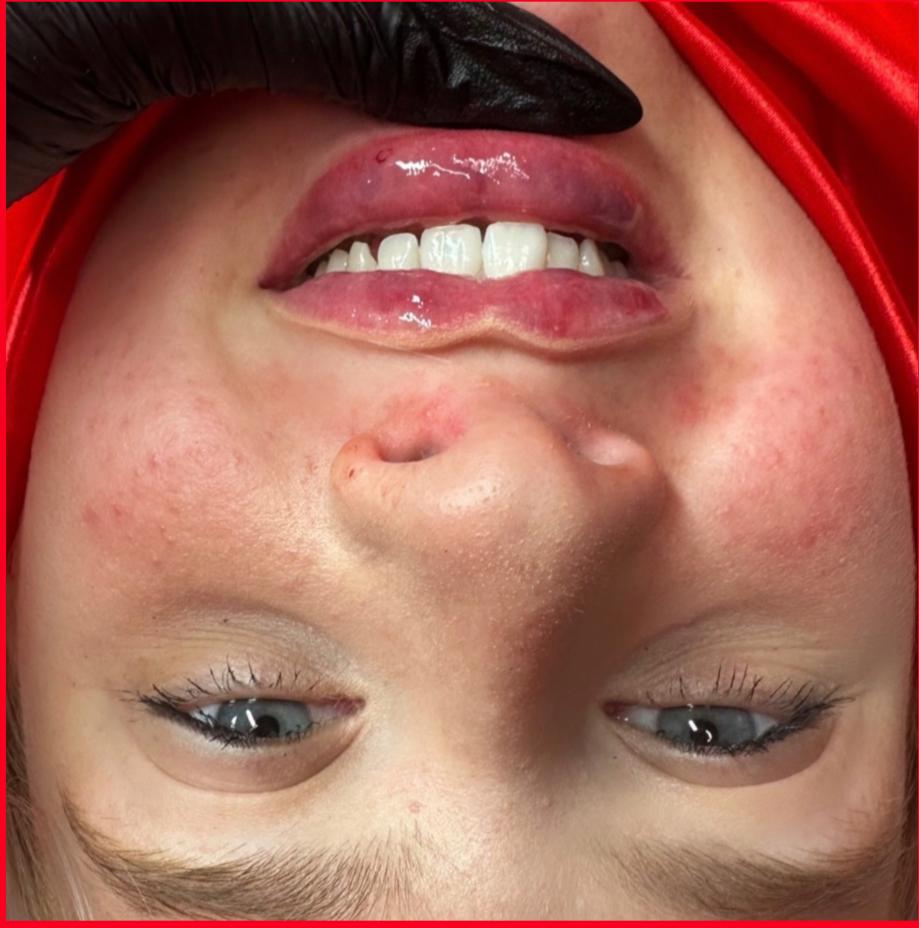 unnamed image